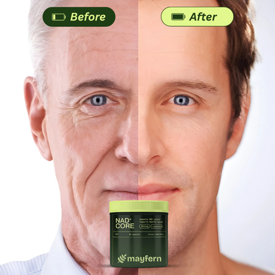 NAD+ Nicotinamide Riboside